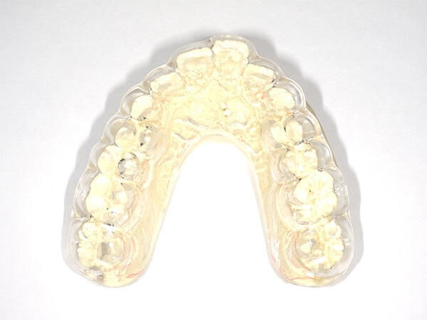 精密マウスピースによる咬合治療